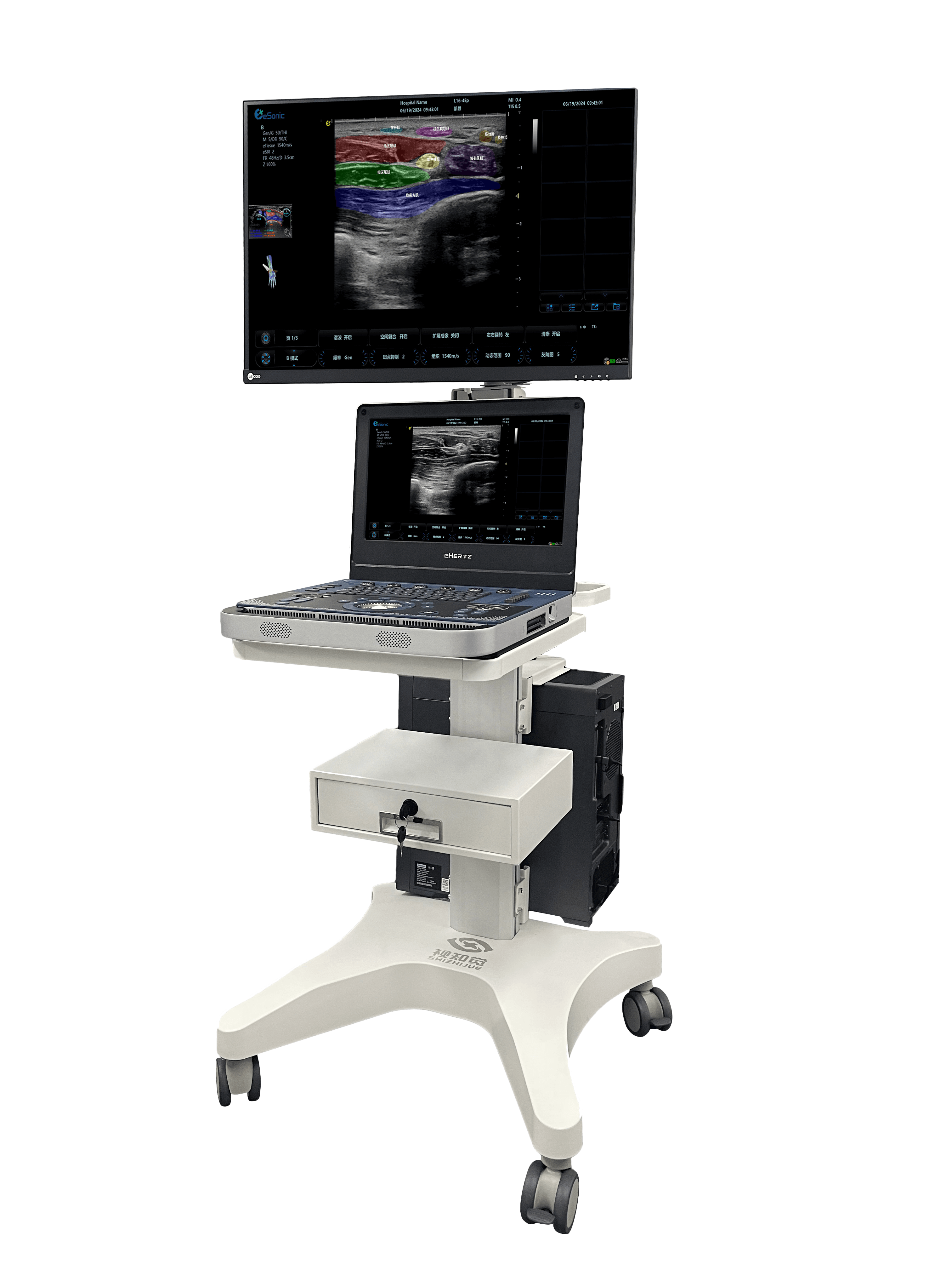 关于我们| 打造临床超声诊疗智能助手